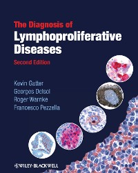 Cover The Diagnosis of Lymphoproliferative Diseases