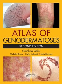 Cover Atlas of Genodermatoses, Second Edition