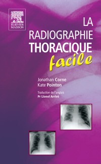 Cover La radiographie thoracique facile