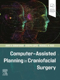 Cover Computer-Assisted Planning in Craniofacial Surgery
