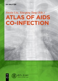 Cover Atlas of AIDS Co-infection