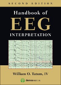 Cover Handbook of EEG Interpretation