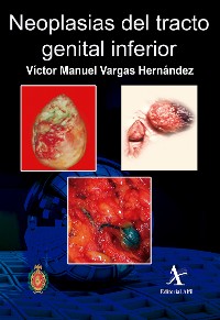 Cover Neoplasias del tracto genital inferior