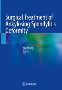 Cover Surgical Treatment of Ankylosing Spondylitis Deformity
