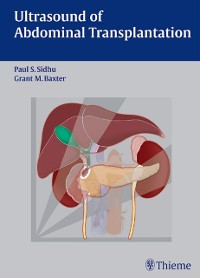 Cover Ultrasound of Abdominal Transplantation