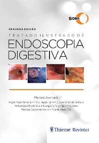 Cover Tratado Ilustrado de Endoscopia Digestiva