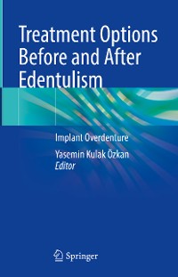 Cover Treatment Options Before and After Edentulism