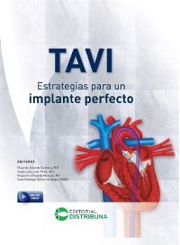 Cover TAVI - Estrategias para un implante perfecto