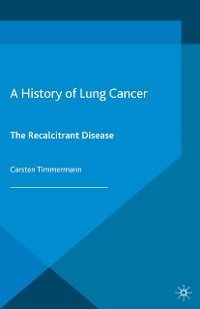 Cover A History of Lung Cancer