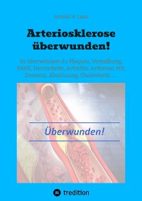 Cover Arteriosklerose überwunden!