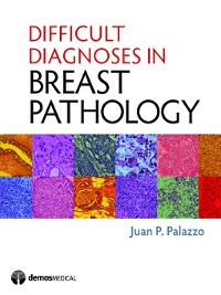 Cover Difficult Diagnoses in Breast Pathology