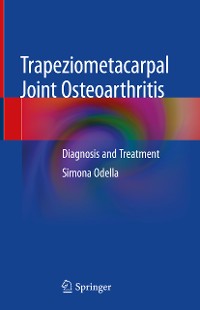 Cover Trapeziometacarpal Joint Osteoarthritis