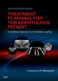 Cover Implant Treatment Planning for the Edentulous Patient