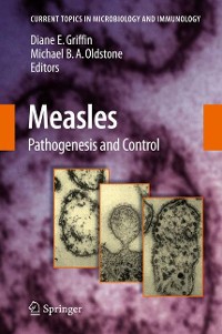Cover Measles