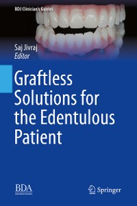 Cover Graftless Solutions for the Edentulous Patient
