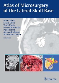 Cover Atlas of Microsurgery of the Lateral Skull Base