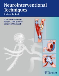 Cover Neurointerventional Techniques