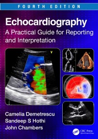 Cover Echocardiography