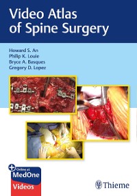 Cover Video Atlas of Spine Surgery