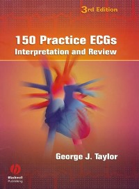 Cover 150 Practice ECGs