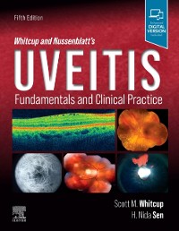 Cover Whitcup and Nussenblatt's Uveitis