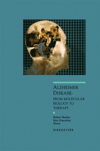 Cover Alzheimer Disease