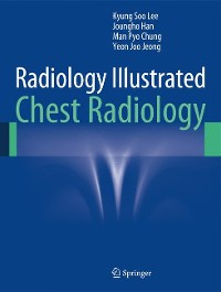 Cover Radiology Illustrated: Chest Radiology