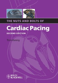 Cover The Nuts and Bolts of Cardiac Pacing