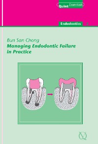 Cover Managing Endodontic Failure in Practice