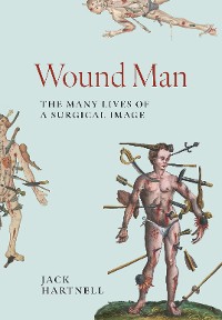 Cover Wound Man