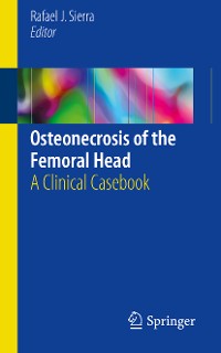 Cover Osteonecrosis of the Femoral Head