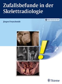 Cover Zufallsbefunde in der Skelettradiologie