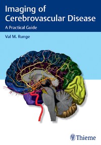 Cover Imaging of Cerebrovascular Disease