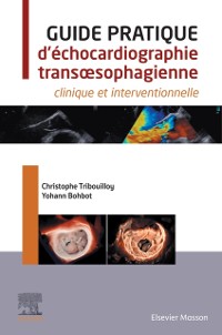 Cover Guide pratique d''échocardiographie transœsophagienne