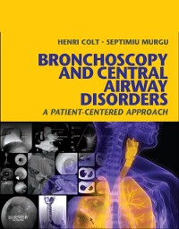 Cover Bronchoscopy and Central Airway Disorders E-Book