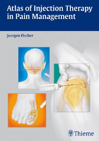 Cover Atlas of Injection Therapy in Pain Management