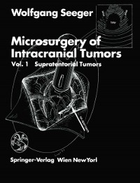 Cover Microsurgery of Intracranial Tumors