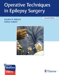 Cover Operative Techniques in Epilepsy Surgery
