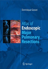 Cover Atlas of endoscopic major pulmonary resections