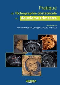 Cover Pratique de l''échographie obstétricale au deuxième trimestre
