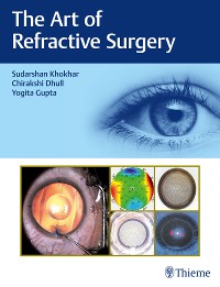 Cover The Art of Refractive Surgery