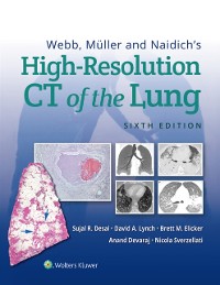 Cover Webb, Muller and Naidich's High-Resolution CT of the Lung