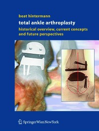 Cover Total Ankle Arthroplasty