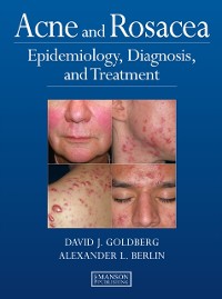 Cover Acne and Rosacea