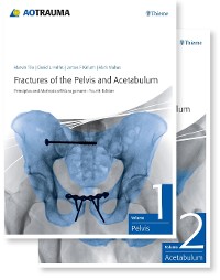 Cover Fractures of the Pelvis and Acetabulum