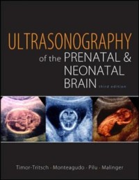 Cover Ultrasonography of the Prenatal Brain, Third Edition
