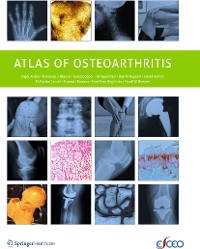Cover Atlas of Osteoarthritis