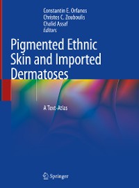 Cover Pigmented Ethnic Skin and Imported Dermatoses