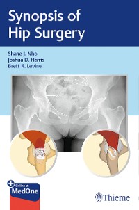 Cover Synopsis of Hip Surgery