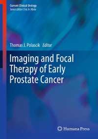 Cover Imaging and Focal Therapy of Early Prostate Cancer
